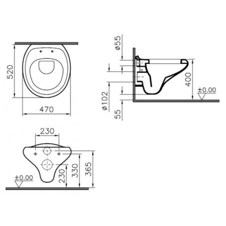 Унитаз подвесной безободковый Vitra Istanbul 4518B403-0075 белый, без сиденья